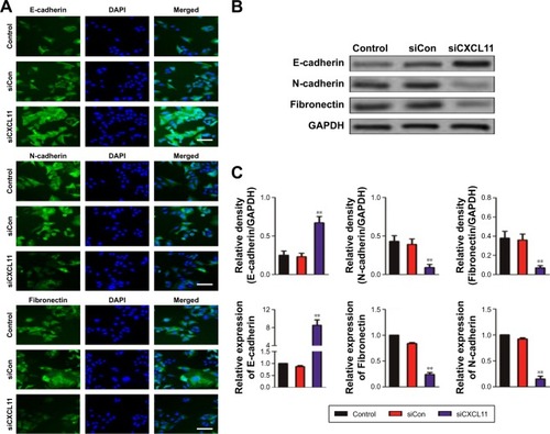 Figure 4 Down-expression of CXCL11 inhibits EMT of SW480 cell.