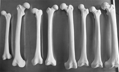 Figure 1. The set of 8 different femurs, including 5 femurs with normal anatomy and 3 with abnormal anatomy. The abnormal femurs comprise one with a pistol grip deformity after slipped epiphysis (3rd from left), one with valgus deformity (6th from left), and one with a severely arthritic head (8th from left).