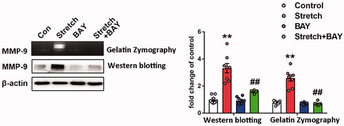 Figure 5. Effects of BAY11-7082 on the expression of MMP-9. MMP-9 activity and expression were analyzed by zymography (upper band) and western blotting (lower band), respectively. Indicative bands were presented on the left of histograms. Data are presented as the mean ± SEM (n = 4). **p < 0.01 vs. control group, ##p < 0.01 vs. ventilation group.