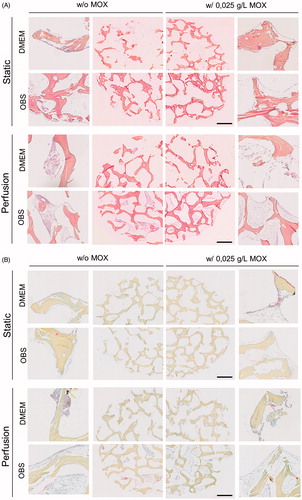Figure 4. Histological analysis of cell distribution throughout BIOBank® scaffolds on resin embedding sections. Representative histological images of undecalcified scaffolds for cultures performed under static or perfusion systems after 4 weeks and stained with HES (A) and Movat’s Pentachrome (B) (Specimens diameter represents 8 mm). (HES stains: blue/black = nuclei; orange/pink = collagen; pink = cytoplasm) (Movat stains: red = fibrin; blue = mucin and extrafibrillar matrix; black = nuclei; yellow = collagen).