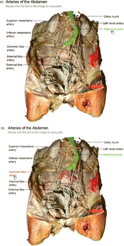 Figure 2. Cadaver image dissected to reveal the major abdominal arteries. (a) Roll-over highlight of abdominal aorta. (b) Roll-over highlight with the abdominal aorta still emphasized but now adding in two branches, the common iliac arteries.