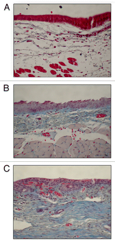Figure 3. Representative 40x coronal sections of the vocal fold treated with a trichrome stain. Statistical significance established by blinded pathologist qualitatively categorizing the fibrosis level for each section. (A) CMHA-S treated vocal folds showing mild fibrosis. Visual inspection indicates a significant decrease in fibrosis between the CMHA-S treatment group and saline-treated controls (p = 0.0158). (B) HA-DTPH-PEGDA treated vocal folds showing moderate fibrosis. No statistical difference between fibrosis levels seen in saline-treated controls (p = 0.1645). (C) Saline treated controls showing moderate fibrosis.