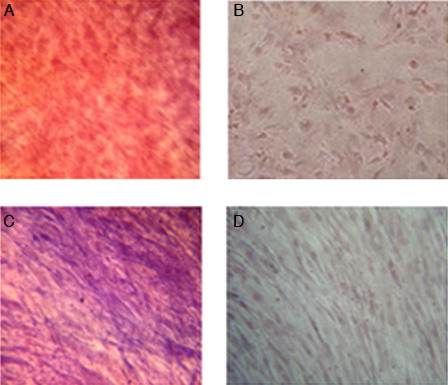 Figure 2. Osteogenic differentiation of MSCs (×40). (A) Positive reaction in osteoblastic differentiated cells with Alizarin red staining. (B) Undifferentiated cells (negative control). (C) Increased alkaline phosphatase activity in osteoblastic differentiated cells. (D) Undifferentiated cells (negative control).