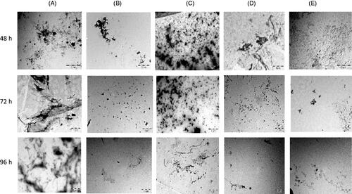 Figure 5. Electron micrographs showing the effects of seaweed extracts (200 µg/mL) on formation of Aβ1-42 fibrils and aggregation at different intervals. (A) Control (Aβ1-42); (B) Aβ1-42 + ECK-AQ; (C) Aβ1-42 + RED-AQ; (D) Aβ1-42 + URL-AQ; (E): Aβ1-42 + GEL-AQ.