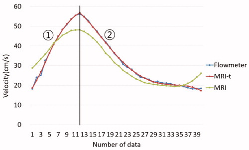 Figure 8. ① First segment was the start point to peak point. ② Second segment was the peak point to end point. A conversion graph (YFlowmeter1(MRI-t)) was derived to sum quartic fitting equation (YMRI1) of PC-MRI and conversion formula (Yt1) that can conversion to electromagnetic flowmeter value. The second segment was same. A conversion graph of first segment was derived by the following equations: yMRI1= 0.0006x4−0.0339x3+0.3628x2+1.2255x+27.218 yt1= 0.0027x4−0.0663x3+0.4915x2+0.705x−11.3550 yMRI1+ yt1= yMRI−t1= yFlowmeter1= 0.0033x4−1.1001x3+0.8543x2+1.9305x+15.863 A conversion graph of second segment was derived by the following equations: yMRI2= −0.0001x4+0.007x3−0.1163x2−1.598x+50.9130 yt2= −0.0001x4+0.0063x3−0.0819x2−0.0874x+7.807 yMRI2+ yt2= yMRI−t2= yFlowmeter2= −0.0002x4+0.0144x3−0.1982x2−1.6854x+58.72