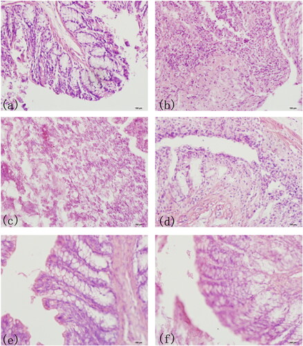 Figure 7. HE Staining of Mice Colon Sections. The complete villus structure and normal goblet cell morphology in normal colon of mice(a); colon biopsy of model UC group in the first day; the colon lesions of model UC group in the 14th day (c); colon of PAE treatment group in the 14th day (d); colon of PAE enema group in the 14th day; colon of PAE-S100 treatment group in the 14th day (f).