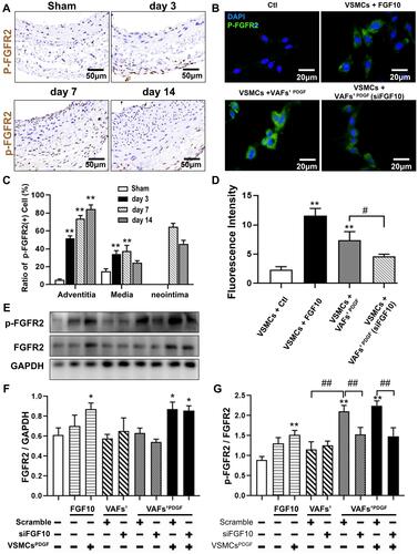 Figure 5 The activities of FGFR2 in VSMCs in vivo and in vitro. (A and C) Representative IHC images of P-FGFR2 staining (A) and its quantitative analysis (C) in rat LCA sections harvested at indicated times after balloon-injury. Scale bar=50μm, n=6. (B and D) Representative immunofluorescence images of P-FGFR2 staining (B) and its quantitative analysis (D) in cultured VSMCs under conditions as indicated. Scale bar=20μm, n=3. (E–G) The protein expression of P-FGFR2 in co-cultured VSMCs under conditions described in Figure 3D were analyzed by WB (E) and its quantitative analyses (F and G), n=3. *p<0.05; **p<0.01 vs Ctl. #p<0.05; ##p<0.01 between two groups as marked.