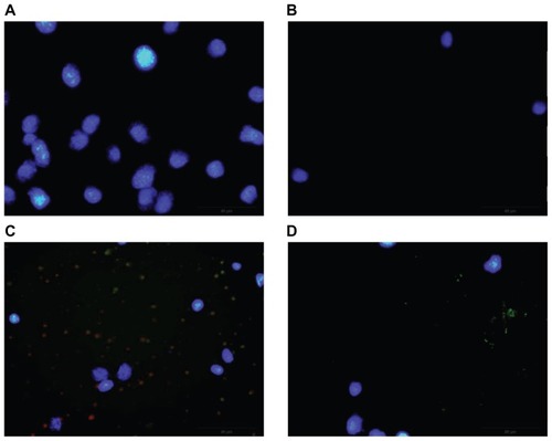 Figure 8 Fluorescence microscopic images of endocytosis of bEND3 cells after 2 hours of incubation of theranostic liposomes pretreated with (A) chlorpromazine, (B) filipin, (C) amiloride, and (D) sodium azide.
