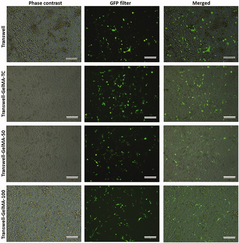 Figure 4. Microscopic images showing the proliferation of endothelial cells over Transwell-GelMA – Astrocyte layer (first column), proliferation of GFP expressing MDA-MB-231 cells over the endothelial cell layer (second column) and merged images showing the proliferation of MDA-MB-231 cells over endothelial cell layer (third column). Endothelial cells and MDA-MB-231 cells were at 72 h and 24 h after cell seeding, respectively. Scale bars, 200 µm.