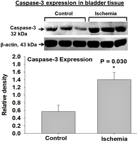 Figure 3 Caspase-3 expression was significantly upregulated in the ischemic bladder tissues in comparison with sham controls. Caspase-3 senses cellular stress intensity and regulates cell fate by either initiating cellular resistance mechanisms against stressful stimuli or activating apoptotic programmed cell death responses. Upregulated caspase-3 may play a mediating role in degenerative response to cellular stress engendered by ischemia. Simultaneous increases in caspase-3 and ASK1 expression, shown in Figure 2, may suggest crosstalk mechanisms between the two molecules under the ischemic conditions in the bladder. * represents significant change in the ischemic tissues versus controls.