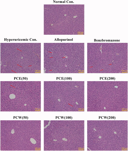 Figure 1. Histological micrographs of liver tissues stained with H&E: normal control, hyperuricemic control, allopurinol control (5 mg/kg), benzbromarzone control (7.8 mg/kg), PCE (50 mg/kg), PCE (100 mg/kg), PCE (200 mg/kg), PCW (50 mg/kg), PCW (100 mg/kg) and PCW (200 mg/kg). Magnification, ×200 ×; scale bar, 100 μm; red arrow, necrotic and/or inflammatory foci.