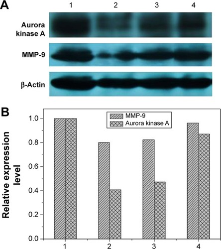 Figure 7 Western blotting (A) and quantitative analysis (B) for the expression level of aurora kinase A and MMP-9 after DNAzyme transfection.Notes: 1: No treatment; 2: N-Ac-l-Leu-PEI/Dz; 3: Lipofectamine™2000/Dz; and 4: N-Ac-l-Leu-PEI/iDz.Abbreviations: N-Ac-l-Leu-PEI, N-acetyl-l-leucine-polyethylenimine; iDz, inactive DNAzyme; MMP-9, matrix metalloproteinase-9.