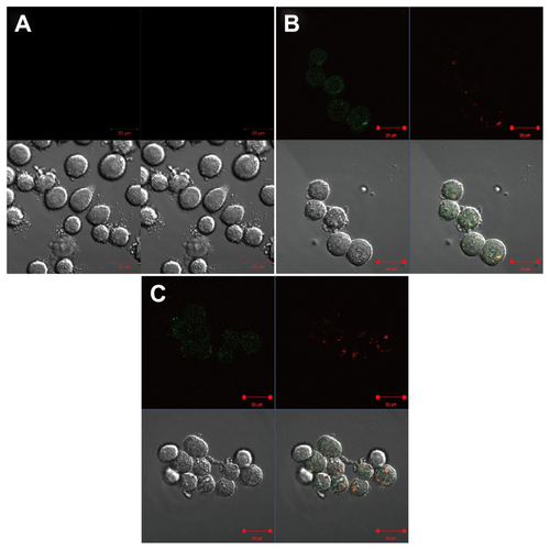 Figure S4 Confocal microscopic analysis of distribution of G5.NHAc-FI-FA/CA4 complexes into KB-HFAR cells. The cells were incubated with (A) phosphate-buffered saline for one hour, (B) G5.NHAc-FI-FA/CA4 complexes for one hour, and (C) G5.NHAc-FI-FA/CA4 complexes for 2 hours, respectively. In (B) and (C), cells were treated with Lyso Tracker Red (50 nM) for an additional one hour after treatment with G5.NHAc-FI-FA/CA4 complexes. The upper left of each panel shows the green fluorescence of fluorescein isothiocyanate, the upper right of each panel shows the red fluorescence of Lyso Tracker Red, the lower left of each panel shows the differential interference contrast images, and the lower right of each panel shows merged images with the above three modes.Abbreviations: G5, generation 5; G5.NHAc-FI-FA, fluorescein isothiocyanate-modified and folic acid-modified G5 PAMAM dendrimers with acetyl terminal groups; CA4, combretastatin A4.