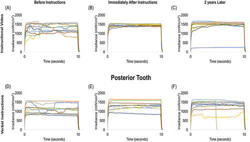Figure 3 Representative measurements of the irradiance values (mW/cm2) delivered to the MARC-PS posterior tooth using the instructional video teaching method: (A) before receiving any instructions, (B) immediately after receiving instructions, and (C) after two years of clinical experience treating patients. Also showing representative measurements of the irradiance values delivered to the MARC-PS posterior tooth using the verbal instructions teaching method: (D) before receiving any instructions, (E) immediately after receiving instructions, and (F) after two years of clinical experience treating patients.