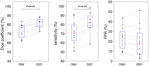 Figure 5. Dice coefficients, sensitivity and FPR of the ablation zone provided by MR-thermometry without and with susceptibility correction. Red lines with blue boxes represent group median with interquartile range for the corresponding data (black dots). p-Values of the Wilcoxon signed-rank test are shown.