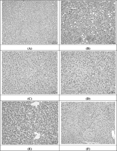 Figure 3.  Effect of emodin and WEP on CCl4-induced liver damage in rats: (A) control group; (B) treated with CCl4 (20% CCl4, 0.5mL/kg bw); (C) treated with CCl4 (20% CCl4, 0.5mL/kg bw) and silymarin (200 mg/kg bw); (D) treated with CCl4 (20% CCl4, 0.5mL/kg bw) and WEP (200 mg/kg bw); (E) treated with CCl4 (20% CCl4, 0.5mL/kg bw) and WEP (400 mg/kg bw); (F) treated with CCl4 (20% CCl4, 0.5mL/kg bw) and emodin (3 mg/kg bw). Scale bars: 20 µm.