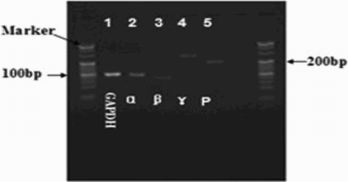 Figure 2 Image of an electrophoresis gel of PCR products of GRα, β, γ, and P. Single band of PCR products showed the absence of other non-specific products among the PCR products.