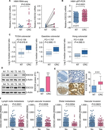 Figure 1 Schmetic of ESCO2 expression that is increased in CRC.Notes: (A) Transcriptome sequencing (RNA-Seq) using eight paired fresh CRC and NT tissues and another four CRC specimens was performed. The expression of ESCO2 is indicated (left panel), and the alteration of ESCO2 expression in paired samples is presented (right panel). Horizontal lines: mean expression level. (B) The increase in ESCO2 mRNA was validated in 211 pairs of clinical specimens using qRT-PCR. (C) ESCO2 upregulation was also found in other studies from oncomine data set. (D) ESCO2 protein expression was determined in 16 paired CRC tissues. Representative Western blot results (left panel) and the related expression levels (right panel) are presented. (E) Expression of ESCO2 protein examined in 106 paraffin-embedded tissues. Representative IHC images (left panel) and scores (right panel) are indicated. (F) Expression of ESCO2 in CRC tissues was compared in patients with or without lymph node metastasis, lymphovascular invasion, distal metastasis, and vascular invasion.Abbreviations: CRC, colorectal cancer; IHC, immunohistochemistry; NT, nontumorous; qRT-PCR, quantitative real-time PCR; TCGA, The Cancer Genome Atlas; FC, fold change; RSEM, RNA-seq by expectation-maximization.