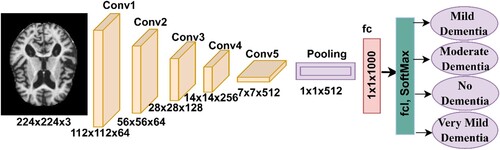 Figure 7. ResNet-18 architecture to classify the Alzheimer’s data set.