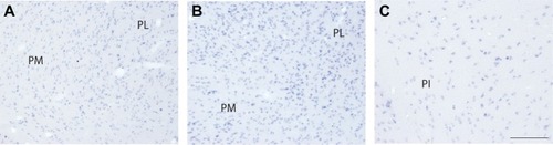 Figure 8 High magnification images of VGLUT2 mRNA expression in each division of the pulvinar complex. A) PM and PL both show intense staining for VGLUT2 mRNA but (B) PL shows a denser distribution of VGLUT2-positive cells than PM. C) PI stains variably in density and intensity for VGLUT2 mRNA, indicated multiple populations of glutamatergic cells in this region. Scale bar is 250 µm.