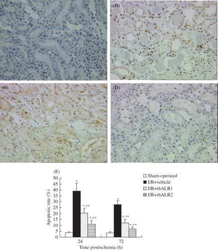 Figure 3. Effects of rhALR treatment on I/R-induced tubular cell apoptosis. Representative sections at 24 h are shown in (A–D). Apoptosis was evaluated by TUNEL staining. Few TUNEL-positive apoptotic cells were noted in the tubular lumen in the normal group (A), but increased numbers of TUNEL-positive cells were observed in the I/R group (B). Few TUNEL-positive cells were seen in the rhALR-treated group, indicating reduced apoptosis (C, D). Magnification ×200. (E) Mean number of apoptotic cells.Notes: Data are expressed as mean ± SD.*Denotes p < 0.05 versus the sham-operated group. **Denotes p < 0.05 versus the I/R+vehicle group.