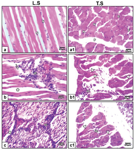 Figure 2. Photomicrographs of histological tibialis muscle fibers sections stained by hematoxylin and eosin (H&E) in 21-day-old rat. (a & a1) control rats showing regular muscle fibers. (b, b1, c & c1) neonates of hyperlipidemic mother showing increased inflammatory cells, separation between muscle fibers and degenerated muscle fibers.