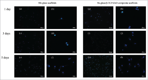 Figure 7. Fluorescence images of MG-63 cell on (A-F) 58s glass scaffolds and (G-L) 58s glass/β-TCP/ZnO composite scaffolds after different days of culture.
