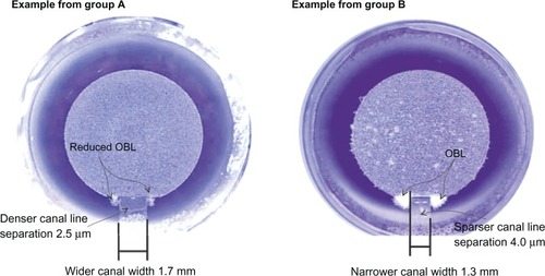 Figure 3 Two representative flaps from group A (canal width 1.7 mm, denser canal line separation, 2.5 μm) and group B (canal width 1.3 mm, sparser canal line separation, 4.0 μm).