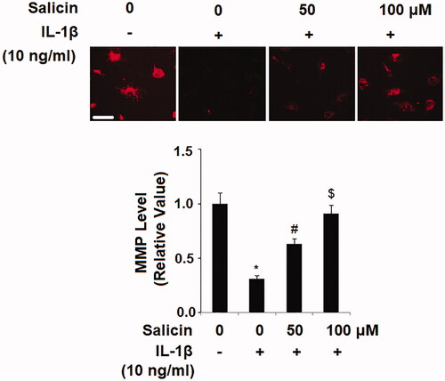 Figure 2. Salicin mitigates IL-1β-induced mitochondrial dysfunction in RECs. Cells were treated with IL-1β (10 ng/mL) in the presence or absence of salicin (50 and 100 μM) for 48 h. The levels of mitochondrial membrane potential (MMP) were determined by tetramethyl rhodamine methyl ester (TMRM) staining. Scale bars, 100 μm (*, #, $, p < .01 vs. previous column group, n = 6).