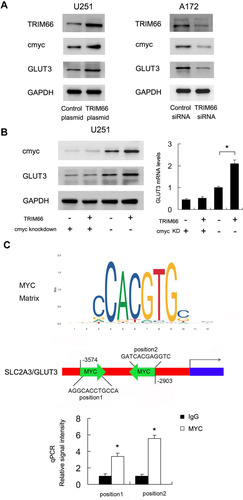 Figure 7 TRIM66 regulates GLUT3 through cMyc. (A) Western blot results showed that TRIM66 overexpression upregulated TRIM66, GLUT3, and cMyc protein while TRIM66 siRNA knockdown downregulated TRIM66, GLUT3 and cMyc protein. (B) cMyc siRNA was transfected with TRIM66 plasmid. cMyc siRNA significantly decreased the expression of cMyc and GLUT3. In cells transfected with cMyc siRNA, the effect of TRIM66 overexpression on GLUT3 protein and mRNA was significantly ameliorated. (C) Prediction of cMyc binding sites on SLC2A3/GLUT3 promoter by JASPAR database analysis. ChIP assay showed that cMyc could bind to the SLC2A3/GLUT3 promoter region. *p<0.05.