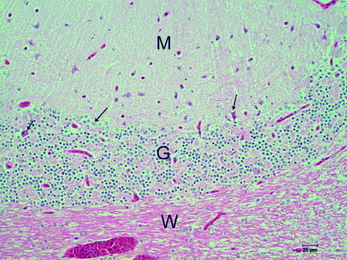 Figure 6.  HE-stained cerebellar cortex of a lesser sulphur crested cockatoo (Case 0570). The Purkinje cell layer (large arrows) is devoid of normal Purkinje cells, with the remnant of one degenerated Purkinje cell still present (right arrow). Another cell identified as a neuron has features suggestive of degeneration (small arrow). M, molecular layer; G, granular layer; W, white matter.