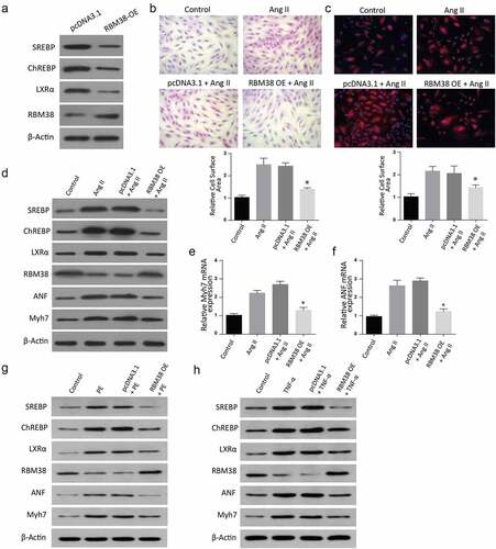 Figure 5. Overexpression of RBM38 rescues Angiotensin II–induced myocardial hypertrophy by regulating LXRα dependent lipogenesis pathway