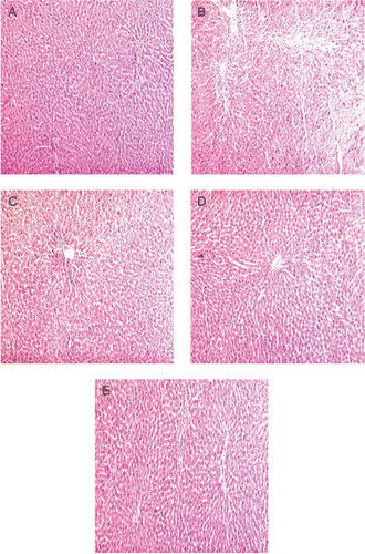 Figure 3.  Photographs of liver sections of APAP-treated rats (hematoxylin and eosin stained, 10x). (A) Normal control, (B) Toxin control (APAP), (C) WFM-400 + APAP, (D) WFM-600 + APAP, (E) Silymarin-100 + APAP.