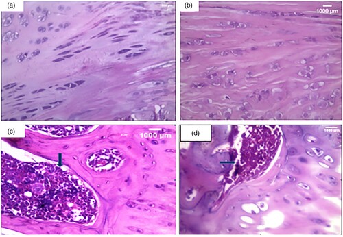 Figure 3. Histopathological examination of knee condyle articular cartilage sections: (a): A section in the articular cartilage of a knee condyle of the normal control group showing normal cartilage. (H&F X400), (b): A section in the articular cartilage of a knee condyle of the irisin-treated group showing normal cartilage with no inflammatory cellular infiltrate … (H&E X400), (c): A section in the arthritic group showing a dense lymphoplasmacytic infiltrate that extends to the subchondral bone illustrated by the blue arrow. (H&E X400), (d): A section of the irisin-treated arthritic group showing a moderate inflammatory cellular infiltrate, illustrated by the blue arrow. (H&E X400).