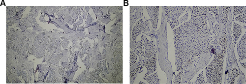 Figure 9 (A and B) Immunostaining for progesterone shows a nuclear pattern of staining.