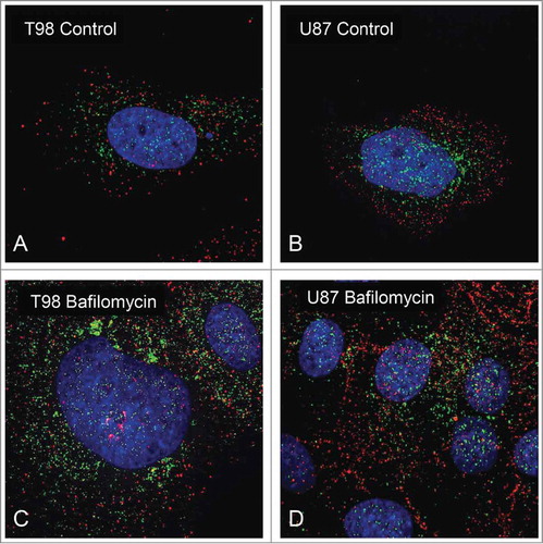 Figure 2. Confocal immunofluorescence microscopy of T98 and U87 glioblastoma cells showing a non-overlapping presence of LC3A and LC3B autophagosomes (A and B). Following exposure to Bafilomycin, LC3A and LC3B autophagosomes were accumulated in the cytoplasm of T98 (2C) and U87 (2D) cells, without any colocalization of the staining.