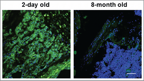 Figure 5. Expression of YAP and TAZ in young vs. aged mice. Immunostaining of YAP/TAZ in the femurs of 2 day-old vs. 8 month-old mice are shown. Scale bar: 100 µm.