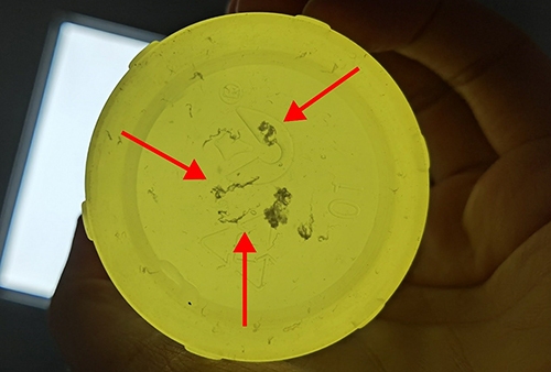 Figure 6 Strip-shaped urinary sediments are visible in the post-treatment urine (the strip-shaped sediments are pointed out by the red arrow).