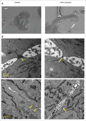 Figure 3. Electron microscopy analysis of alterations in cell morphology and cell-cell junction organization upon GRAF1 knockdown. (A) Scanning electron microscopy images of the small colonies of control and GRAF1-depleted cells. Note that the colony of GRAF1 depleted cells, as well as individual cells, are more elongated. The “leading” cell (denoted by a white arrow) of the GRAF1 depleted colony displays a large lamellum and numerous filopodia. (B) Disruption of cell-cell contacts seen by transmission electron microscopy. Upper row: Note smaller desmososmes and less prominent arrays of intermediate filaments (presumable cytokeratin filaments) in GRAF1-depleted cells (yellow arrow in the right image), as compared to controls(arrowhead in the left image). Lower row: The control cells (left) are characterized by wide adherens junctions (arrowheads), while GRAF1-depleted cells (right) demonstrate instead open intercellular spaces with multiple microvilli (yellow arrow).