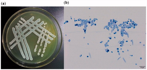 Figure 2. Yeast strain YF1503 colony morphology on WL medium (a) and cell morphology (b) captured by optical microscope (10 × 100).