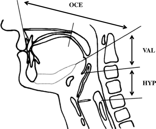 Fig. 3. Positions of the leading edge of the bolus upon the swallowing reflex.Note: OCE, oral cavity area or epipharyngeal area. VAL, vallecular area. HYP, hypopharyngeal area.