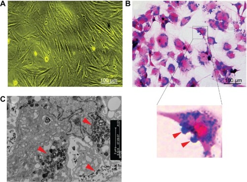 Figure 1 Cell labeling.Notes: (A) Non-labeled bone marrow-derived mesenchymal stem cells in vitro (×100). (B) Prussian blue-stained, labeled cells (×100). The majority of blue-stained iron particles were distributed in the cytoplasm, whereas a small amount of particles adhered to the cell membrane (red arrows in inset). (C) Electron microscopic images of labeled MSCs shows dense particles (red arrows) clustered within the cytoplasm.