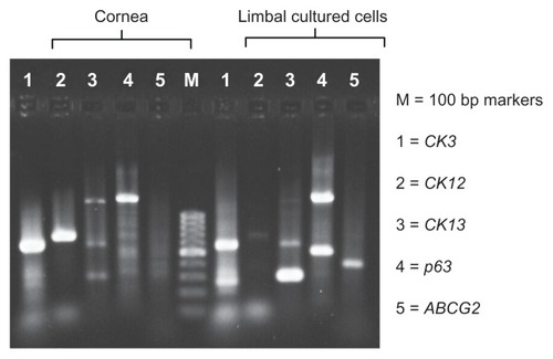 Figure 2 RT-PCR study showing expression of differentiation and stem-cell markers (CK3, CK12, CK13, ABCG2, and p63).