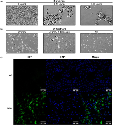 Figure 2. Enrichment of GFP expressing transduced ReN cells using puromycin antibiotic selection. (a) Kill curve with puromycin antibiotic on non-treated ReN cells revealed a concentration of 0.5 µg/mL was sufficient to kill all cells after 48 hours. (b) Lentiviral-transduced ReN cells can be selected with puromycin antibiotic treatment. ReN cells were treated with 1 μL of mouse PrPC expressing lentiviral prep (LV-prep) for 72 hours, with or without TransDux enhancer, at which point the cells were treated with 0.5 μg/mL puromycin. Images were taken with a phase contrast microscope 3 days following puromycin treatment. (c) GFP expression in ReN cells before and after lentiviral transduction. Cells were fixed and stained with DAPI before imaging for GFP via fluorescence microscopy. Images were acquired using the 40X oil objective of a Zeiss LSM 700 instrument (scale bar = 50 µm).