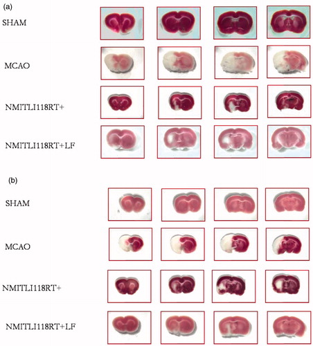 Figure 10. (a) Brain slices stained with TTC showing the effect of pre-treatment (1 h) and (b) post-treatment (6 h) of NMITLI118RT+ and NMITLI118RT+LF following I/R injury.