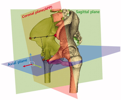 Figure 1. Three-dimensional pelvic coordinate system. The most ventral points were automatically located on the anterior superior iliac spine and pubic tubercles bilaterally (red points) and were used to establish the three-dimensional pelvic reference frame. The anterior pelvic plane, or coronal plane (red plane), consisted of the anterior superior iliac spine and the pubic tubercle points bilaterally. The sagittal plane (green plane) contained the line (dashed line) connecting the two midpoints of the bilateral anatomical landmarks and was normal to the APP. The axial plane (blue plane) was normal to both coronal and sagittal planes.