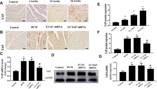 Figure 1 YAP expression in the myocardium in vivo (n=6). (A) Representative immunohistochemical staining of YAP at different time points (scale bar=20 μm). (B) Representative immunohistochemical staining of YAP in the 4 groups (scale bar=20 μm). (C) YAP mRNA expression. (D) Western blot analysis of YAP protein expression. (E) Quantitative analysis of YAP protein expression shown in A. (F) Quantitative analysis of YAP protein expression shown in (B). (G) Quantitative analysis of YAP protein expression shown in (D). *P<0.05 versus the control group; #P<0.05 versus the LV-SC-shRNA group.