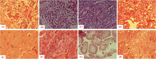 Figure 5. Microscopic examination of histopathologic changes in different tissues collected from chickens infected with the mesogenic strain. Arrows indicate histologic and pathologic lesions in (A) trachea, (B) lung, (C) kidney, (D) spleen, (E) brain, (F) liver, (G) bursa of Fabricius and (H) small intestine.