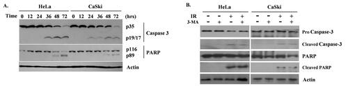 Figure 3. Western blot to examine Caspase-3 and PARP of HeLa and CaSki cells after radiation of 2 Gy. (A) Apoptosis occurred 48 hours after radiation initiation, 24 hours later than autophagy. (B) When autophagy was inhibited by 3-MA, apoptosis decreased as well in both cell lines.