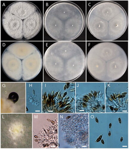 Figure 9. Morphology of Monochaetia camelliae. (A, D) Colonies on PDA; (B, E) Colonies on MEA; (C, F) Colonies on OA ((A–C) obverse view; (D–F) reverse view); (G) Conidiomata; (H–K, M) Conidiogenous cells and conidia; (L) Exudate on OA; (N) Conidiomatal wall; (O) Conidia (scale bars: H–K, M–O = 10 μm).